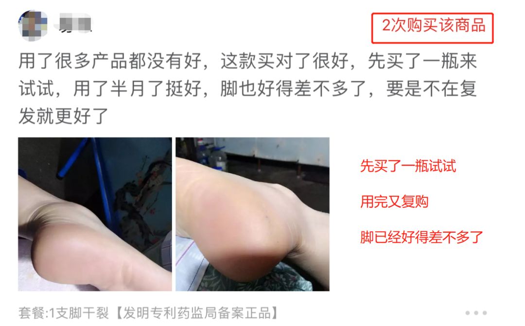 后脚跟干裂护足霜排行榜第一名,护脚霜脚后跟干裂修复霜国货