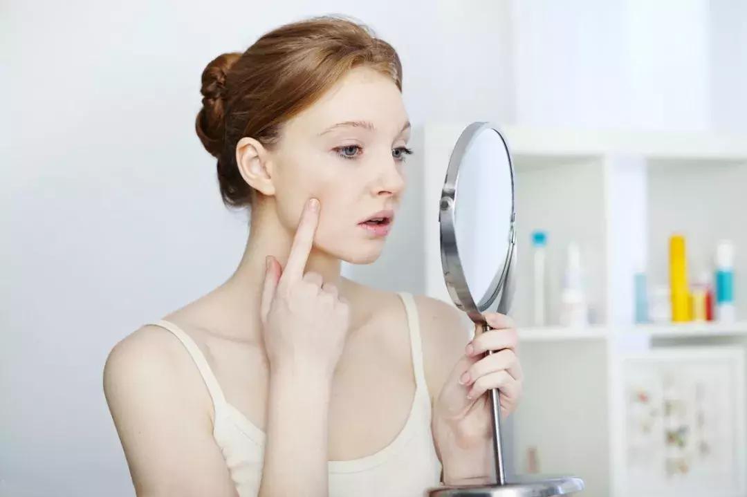 皮肤管理丨假期结束,和你一起上班的可能还有痘痘...