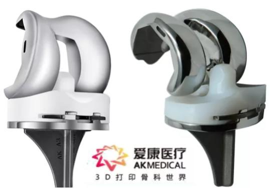 世界首例！我国华西医院成功植入3D打印生物型人工膝关节