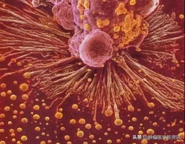 全世界治疗癌症的药物,日本癌细胞免疫疗法