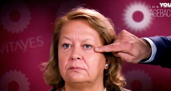 补水保湿淡化黑眼圈眼袋,黑眼袋黑眼圈用什么护肤品消除