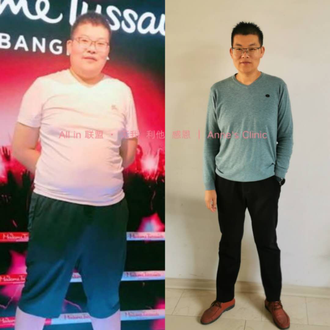 用过十几种减肥方法最终被安馨3021干掉60斤肥肉