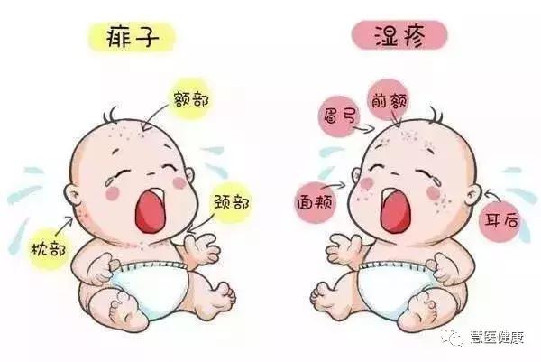 宝宝湿疹和痱子的区别和治疗方法,宝宝痱子湿疹怎么消除效果好