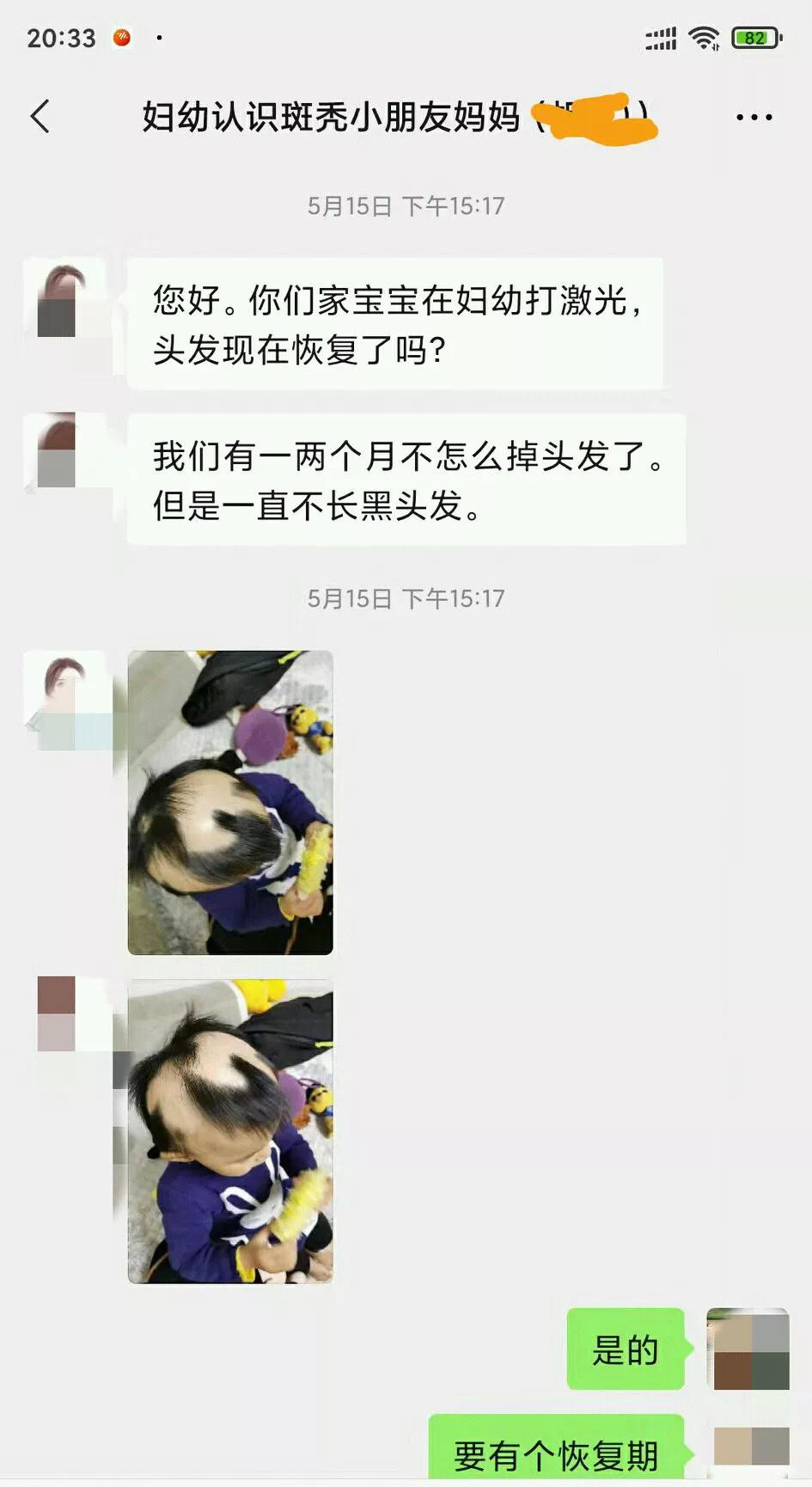 斑秃属于疑难杂症么,斑秃治疗中越来越严重怎么回事