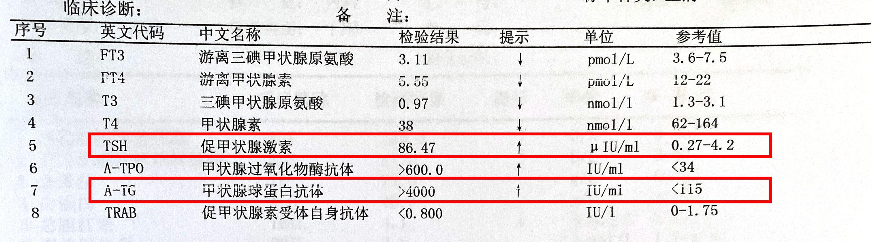 桥本亚临床甲减喉咙发紧,亚临床桥本甲减脖子会疼吗