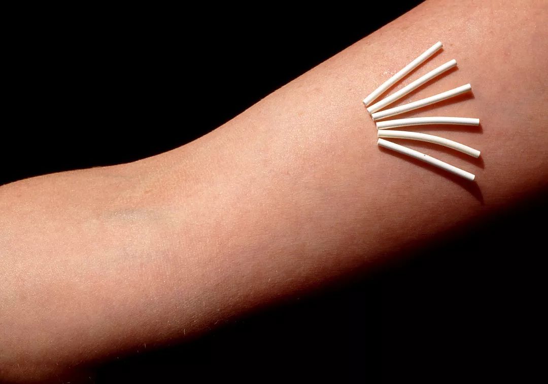 在美国做手术的体验,在美国做妇科手术