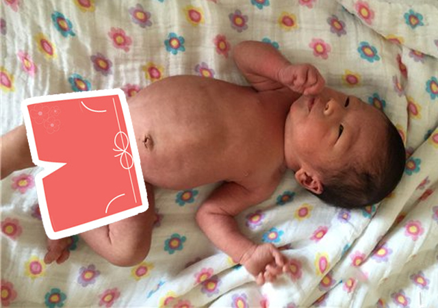 宝宝肚子鼓鼓胀气怎么办,肚子胀气跟气球一样是什么原因