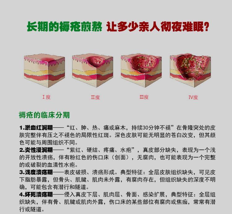 压疮和褥疮是一回事吗,压疮褥疮是一回事吗