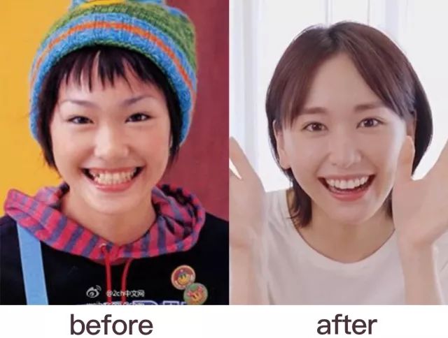 日本水原希子整容,水原希子真的整容了吗