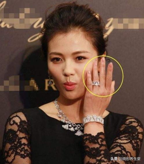 手部皮肤粗糙是缺什么,手部蜡黄暗沉