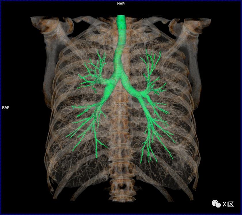 如此详细的肺部影像解剖，有点儿酷