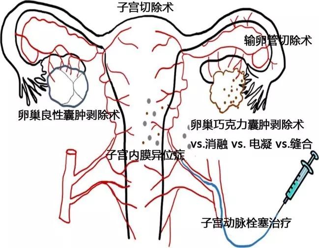 amh0.01还有卵泡吗,amh11