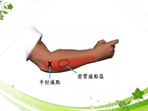 得了网球肘胳膊肘老是疼怎么办,打羽毛球胳膊肘疼是网球肘吗