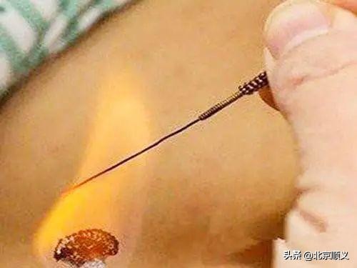 中医药健康节活动,首届养生文化节优惠不断