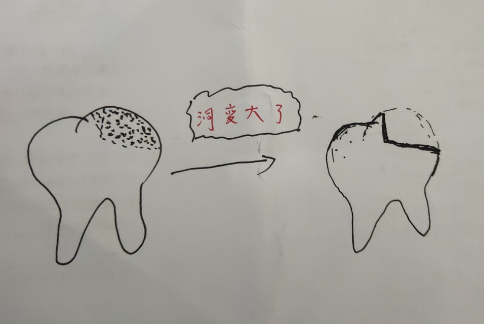 口腔牙齿出了问题怎么办,牙医说牙齿有洞怎么处理
