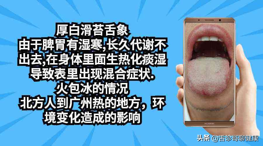 尿路结石口干舌燥恶心,尿路结石导致恶心呕吐不尿尿