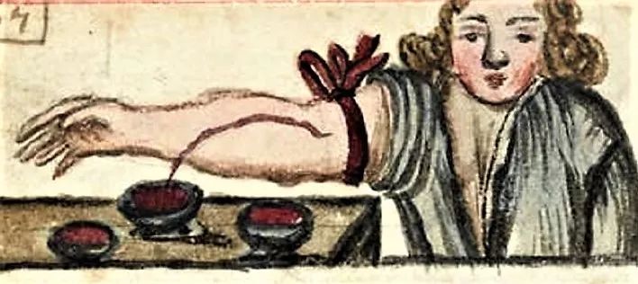 放血和灌肠疗法,灌肠放血的正确方法是什么