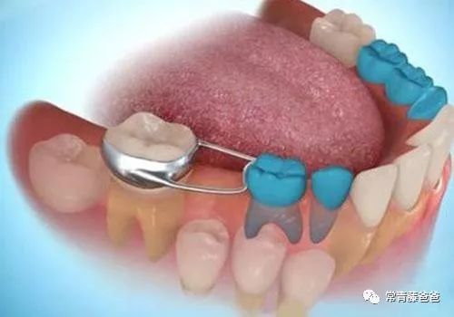 爱牙日保护你的口腔健康,爱牙日从定期口腔检查开始