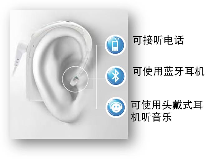 儿童怎么选择人工耳蜗,为儿童选助听器的音质