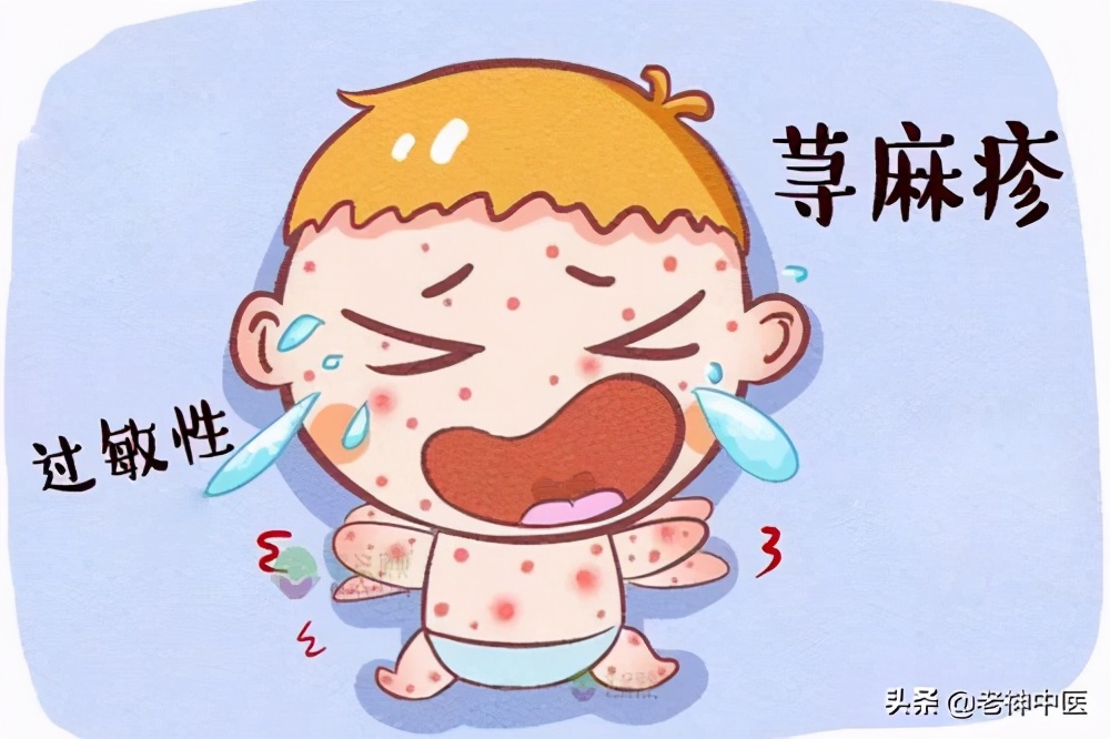顽固性荨麻疹中医疗法,麻疹反反复复最快治疗方法