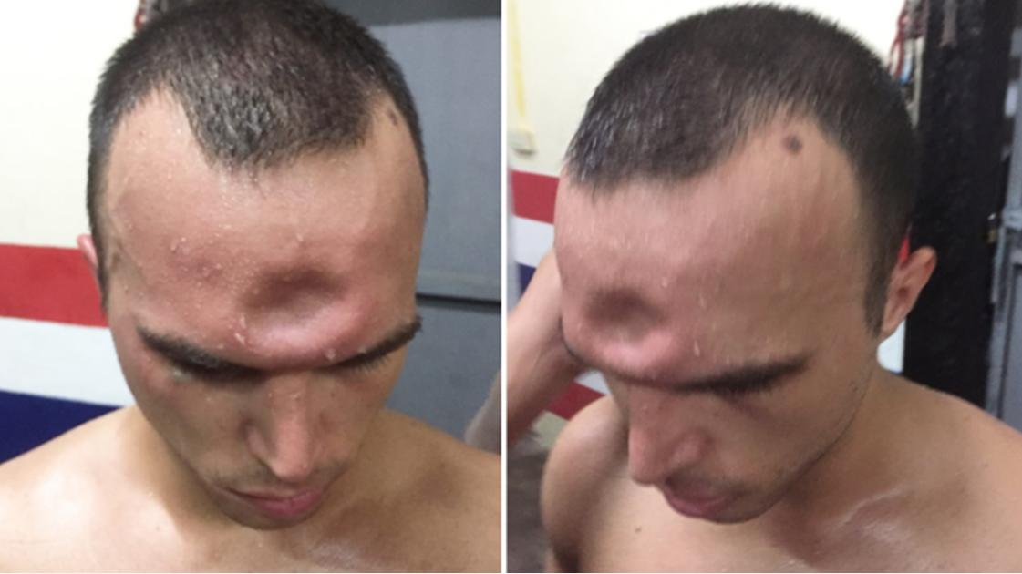 你这一胳膊肘下去,对方的头骨都可能会被干裂?硬核分析不容错过