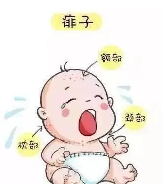 为什么小孩长痱子大人不长痱子,宝宝夏季不开空调长痱子