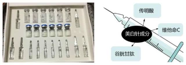 大S美白针效果如何,大s美白针的副作用