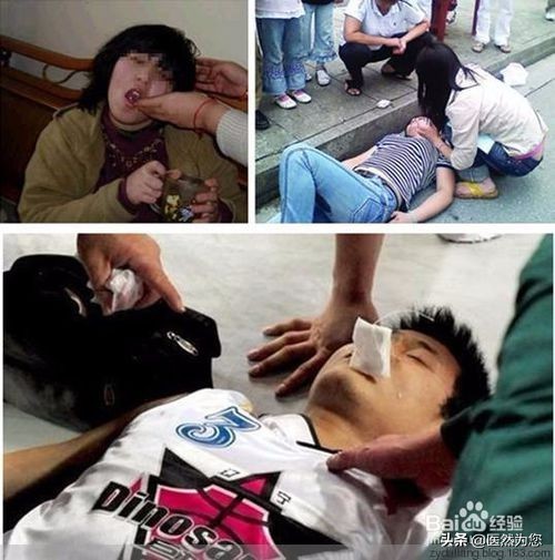 癫痫抽搐有什么症状,癫痫病抽搐症状有哪些