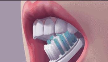 各种治牙方法疼痛分级,牙疼痛要警惕四种病