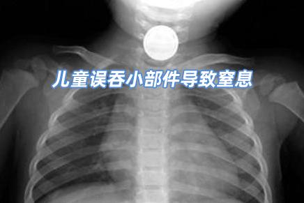 买童装要注意哪些问题,童装买前注意事项有哪些