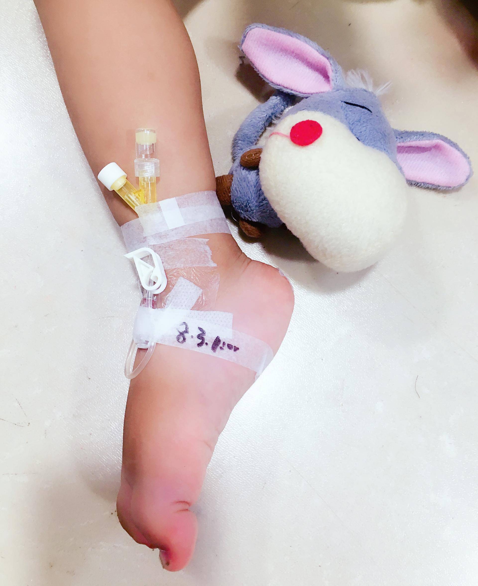 儿科留置针规范使用与维护,宝宝留置针如何保护