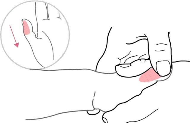 小儿推拿脐灸能治疗湿疹吗,小儿推拿治疗湿疹有效果吗