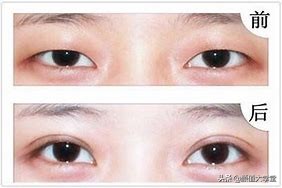 眼睛无神呆滞不灵活,眼睛无神呆滞精神涣散