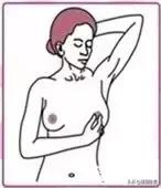 乳腺增生会变癌吗,乳腺增生可以艾灸乳房吗