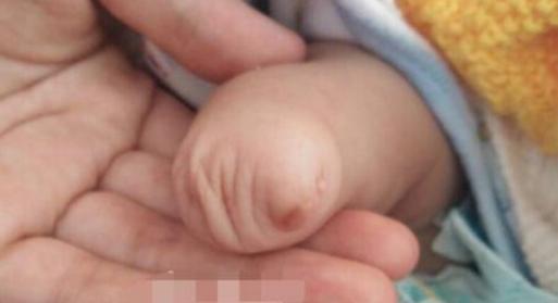 孩子出生时少了1只手，大夫都难以相信，竟是孕妈妈的恶习引起的