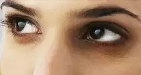 改善眼袋仅980元不开刀让你更出众,消除眼袋细纹大概多少钱