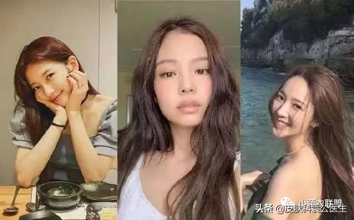 脱发严重但是头发还是很浓密,脱发头发油腻怎么办