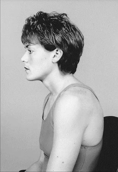 麦肯基疗法治颈椎全套视频,麦肯基治疗神经根型颈椎病