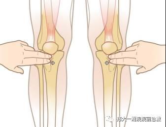 如何提高静脉输液速度的准确率,输液疗法是怎么发明的