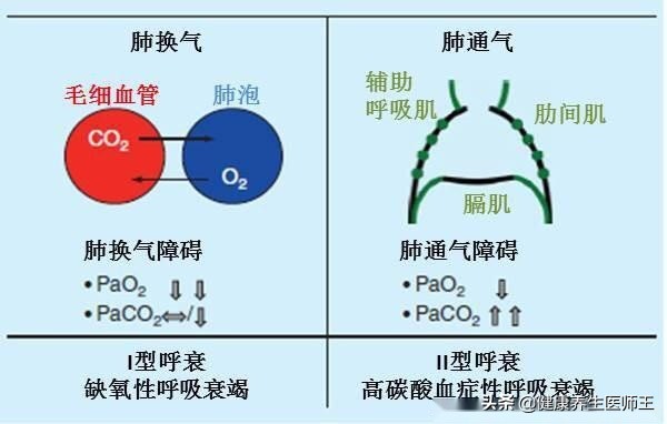 呼吸衰竭的分型有,呼吸衰竭的分型及标准