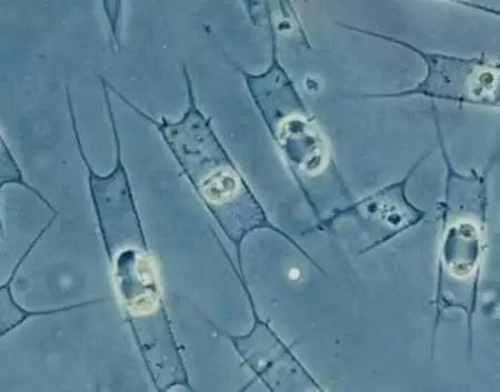 水产养殖藻类老化是怎样的,水产养殖显微镜下各种藻类