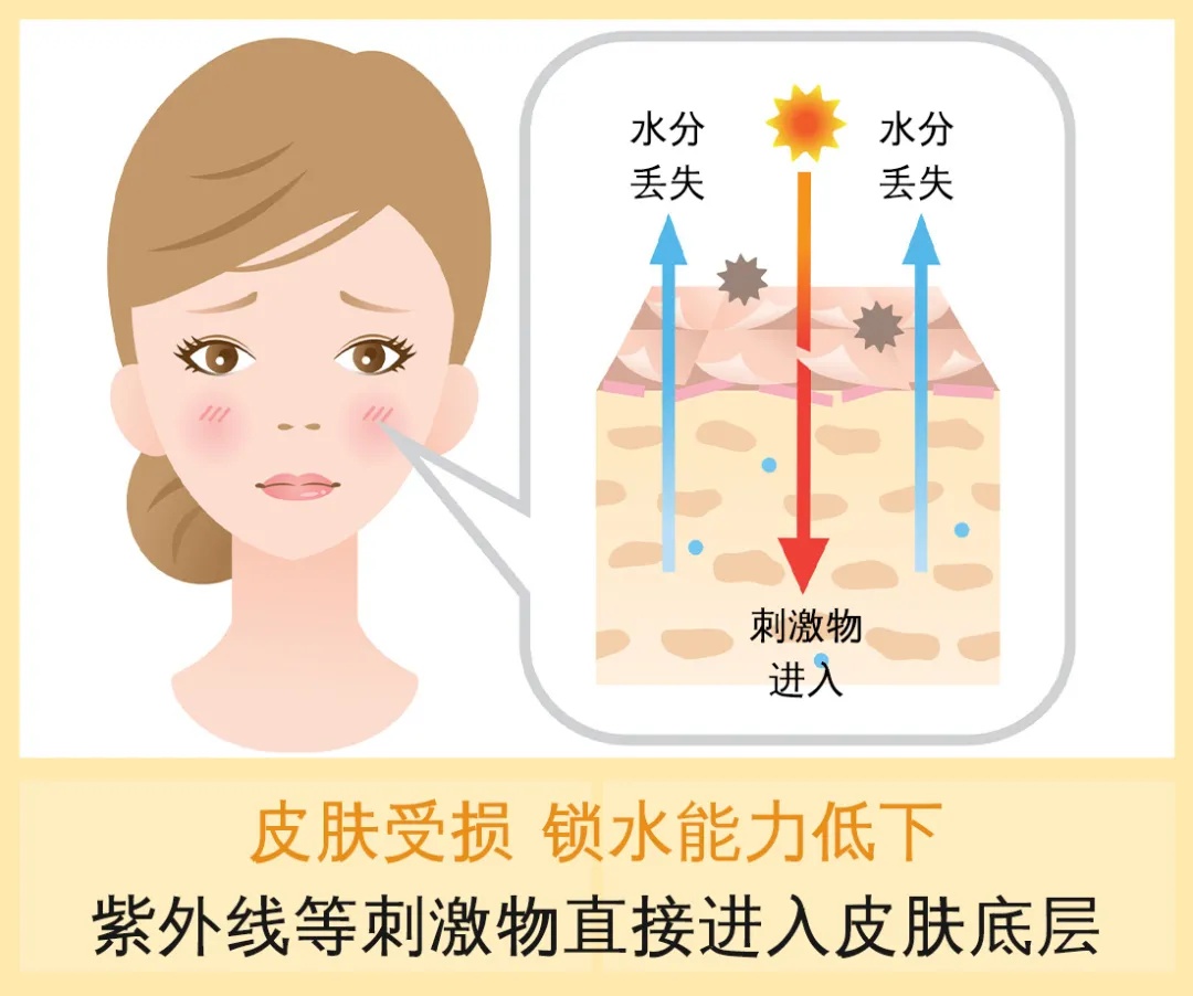 敏感长痘红痒该怎么办,红痘痒痛