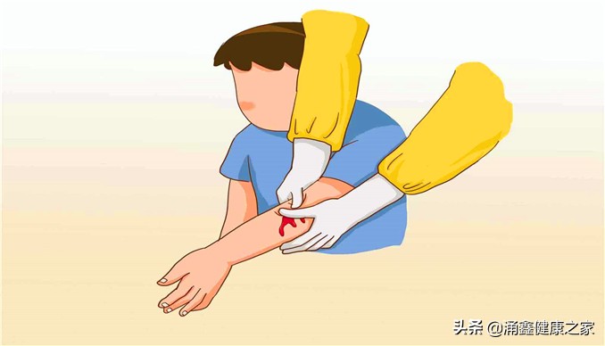 碘伏、碘酒、酒精……受伤之后该如何选择？