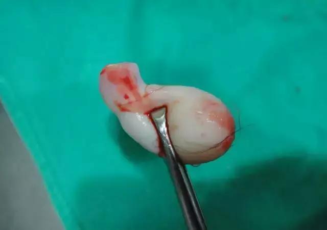 孕妇顺产38天后，莫名掉出“一块肉”，医生怒骂老公“蠢货”