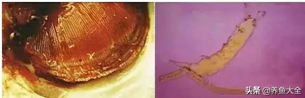 寄生虫多达6000条这种东西别乱吃,寄生虫的典型症状和表现