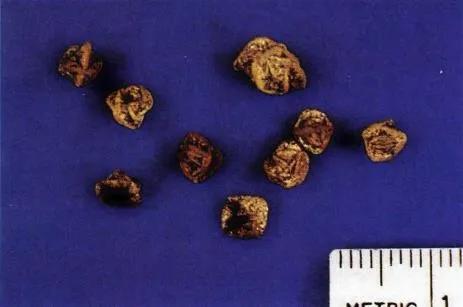 猫咪尿结石可以喝排石颗粒吗,怎么区分猫咪尿结石还是尿路感染