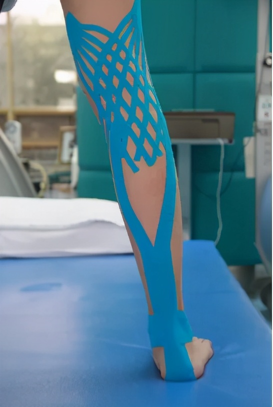 弹性贴布的原理,弹性贴布的作用