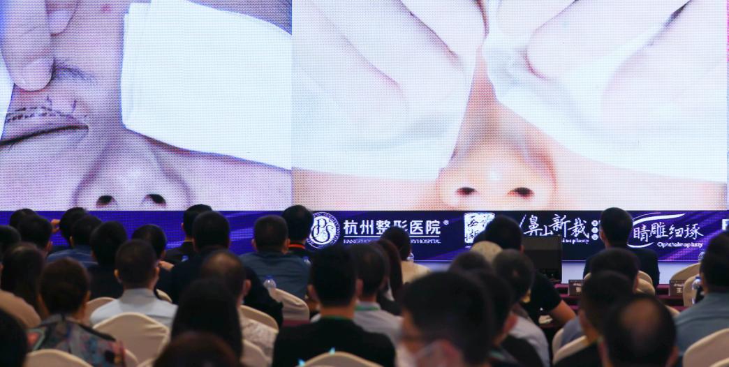 潘二博士双眼皮修复失败案例,潘二医生双眼皮