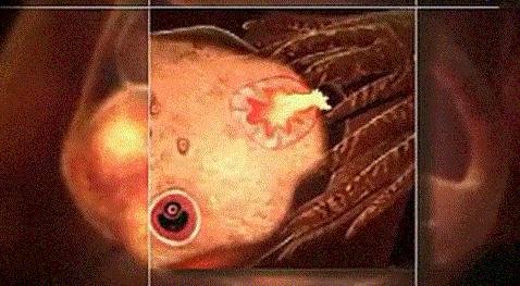 怎样才能知道卵泡有没有正常发育、排卵呢？生殖科医生：B超监测