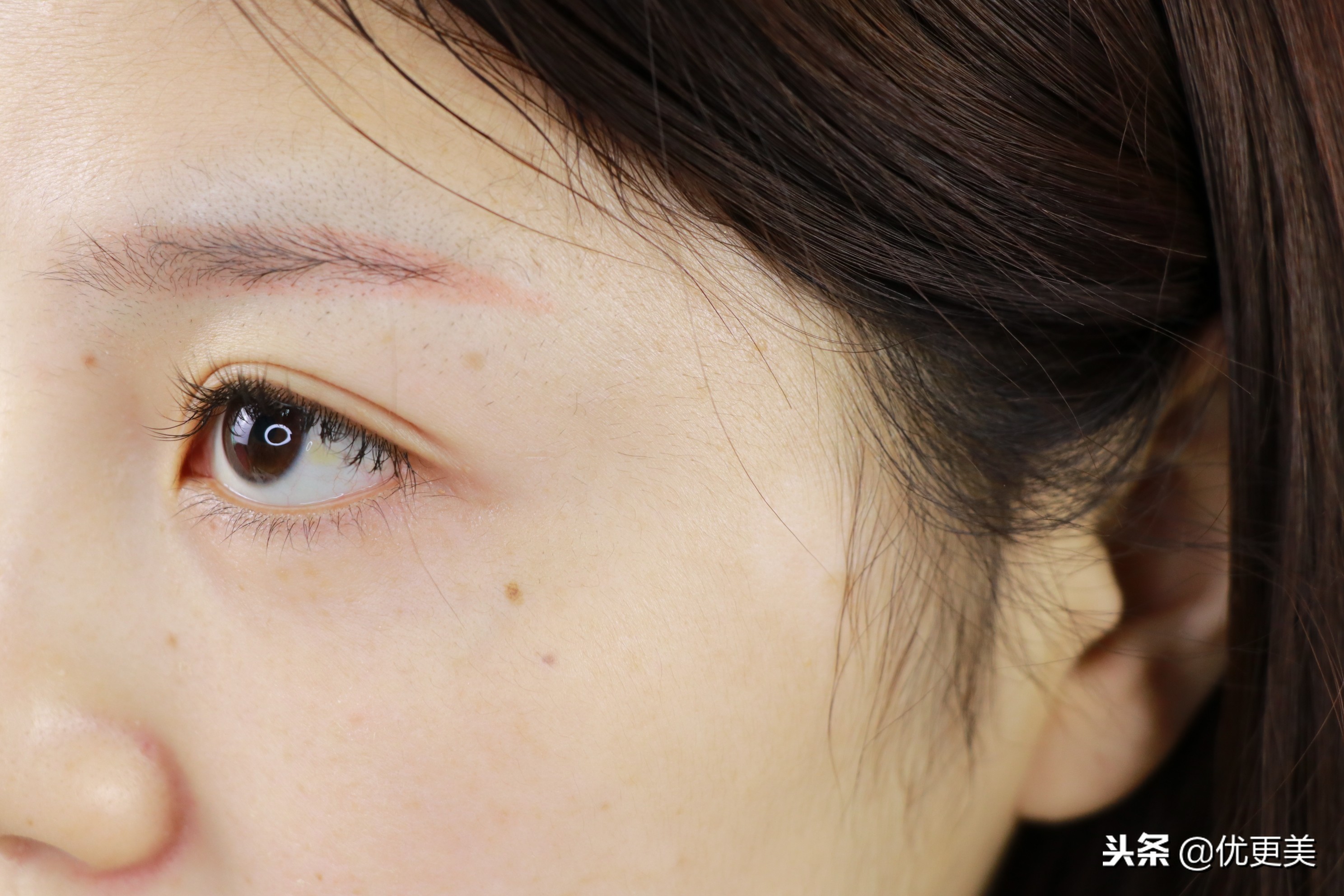 注射式眼部精华，眼周细纹快走开